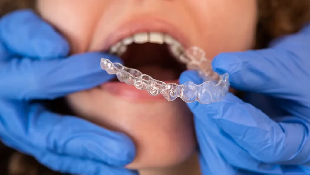 How does the Invisalign treatment process work