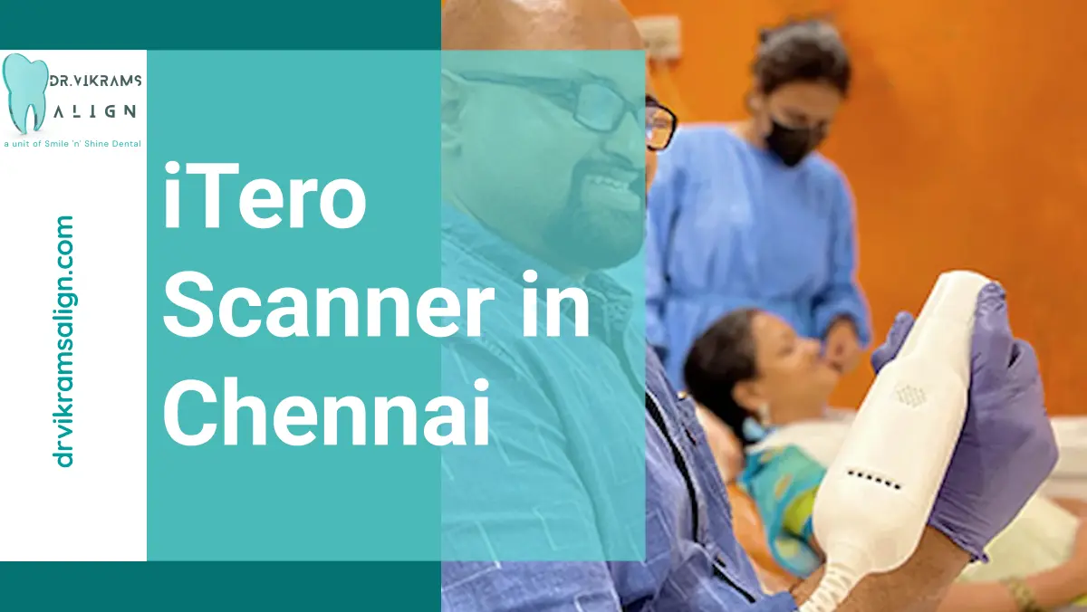 ITERO Scanner in Chennai | Dr. Vikrams Align