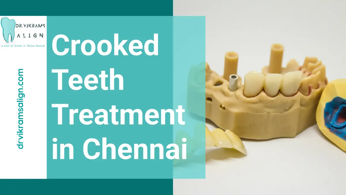 crooked teeth treatment in chennai