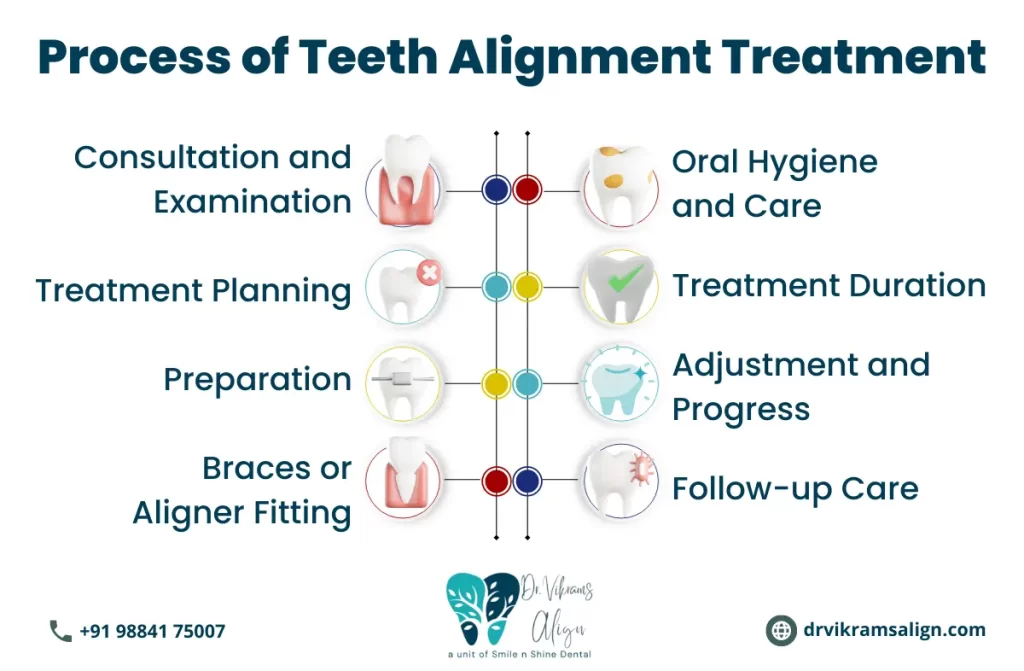 Teeth alignment treatment in Chennai | Dr. Vikram’s Align