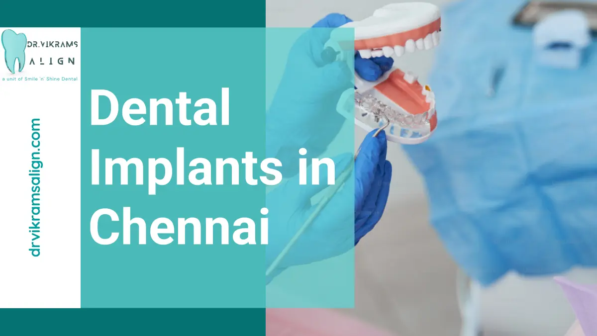 Dental Implants in Chennai | Dr. Vikrams Align