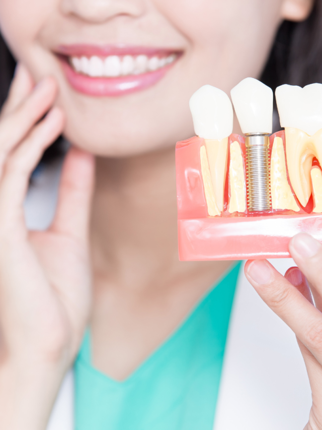 Best Dentist in Anna Nagar