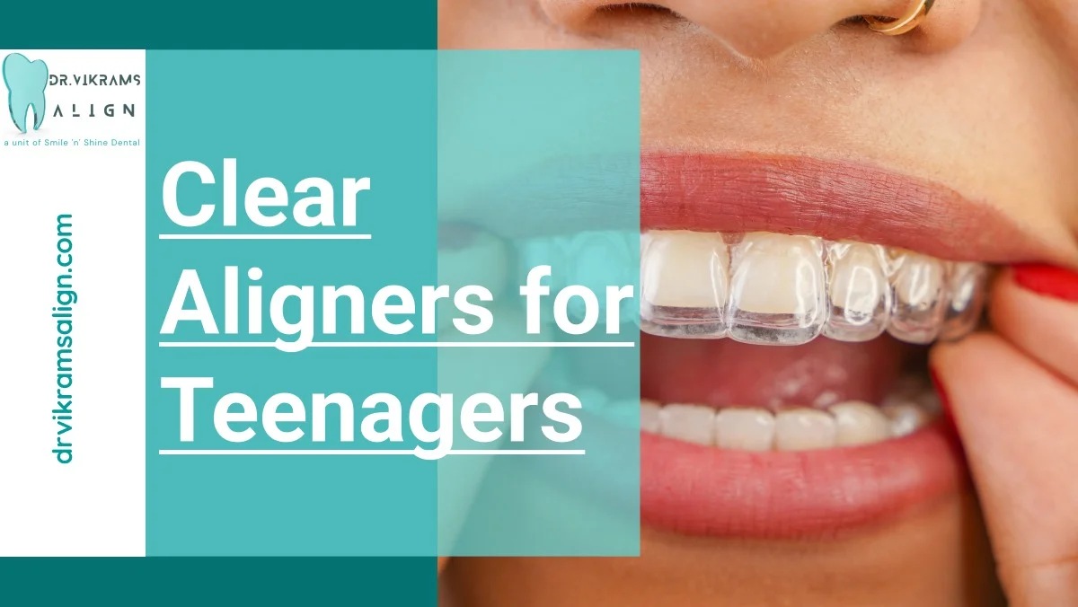 Clear Aligners for Teenagers