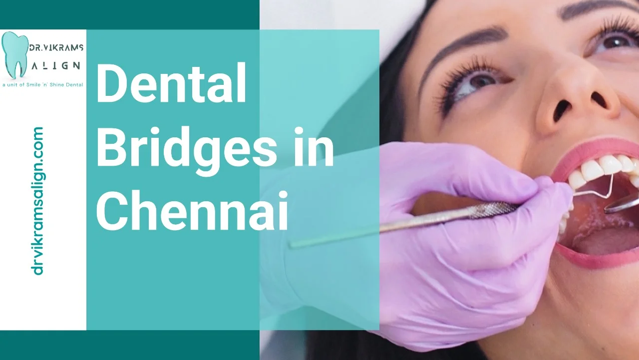 Dental Bridges in Chennai
