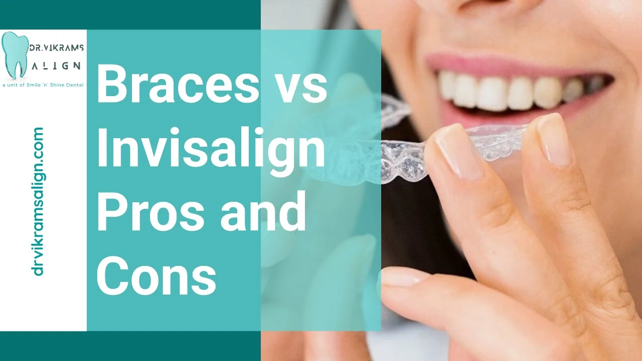 Braces vs Invisalign Pros and Cons