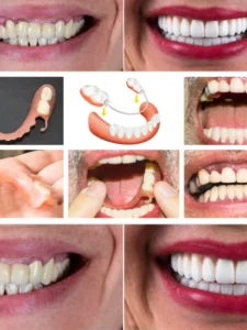 Smile Correction Center in Chennai (4)