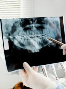 cropped-Smile-Correction-Center-in-Chennai-6.webp