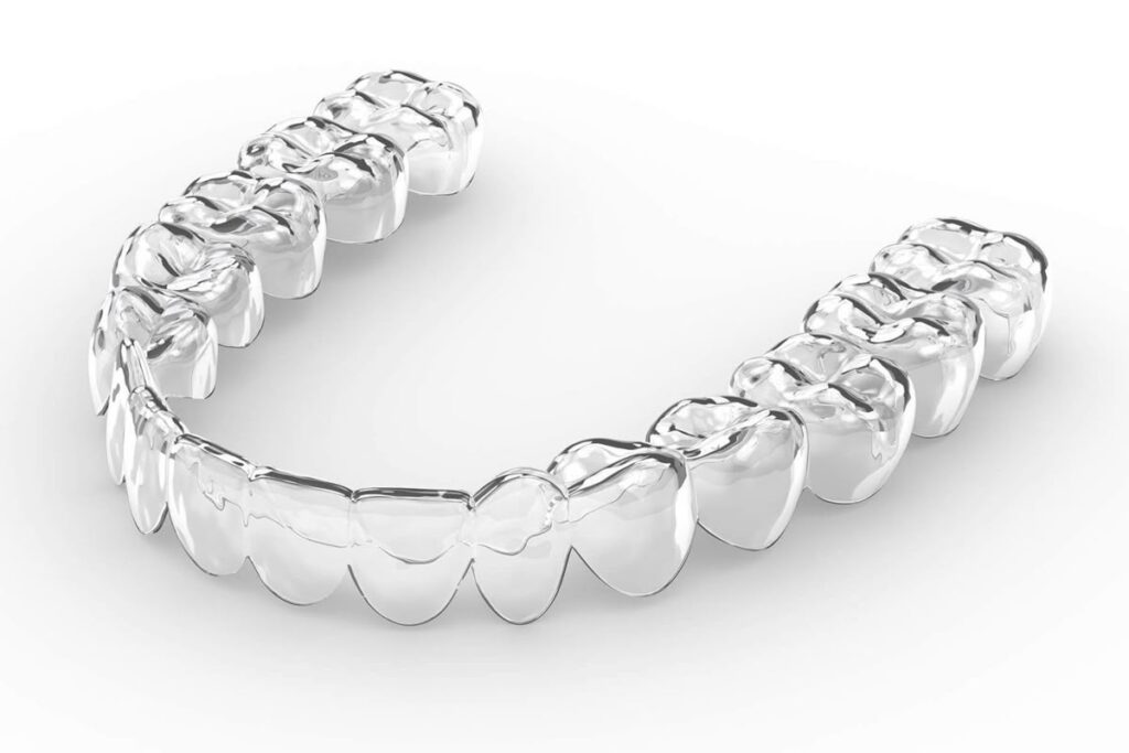 Clear Aligners for Overbite – A Modern Solution at Dr. Vikram’s Align 1 bafeede42cbf7e978902c04f741cc0a4