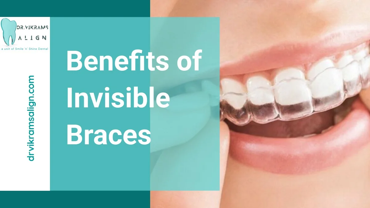 benefits of invisible braces